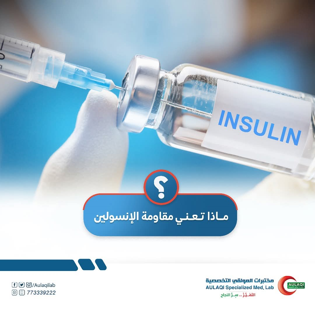 فحص مقاومة الانسولين HOMA IR