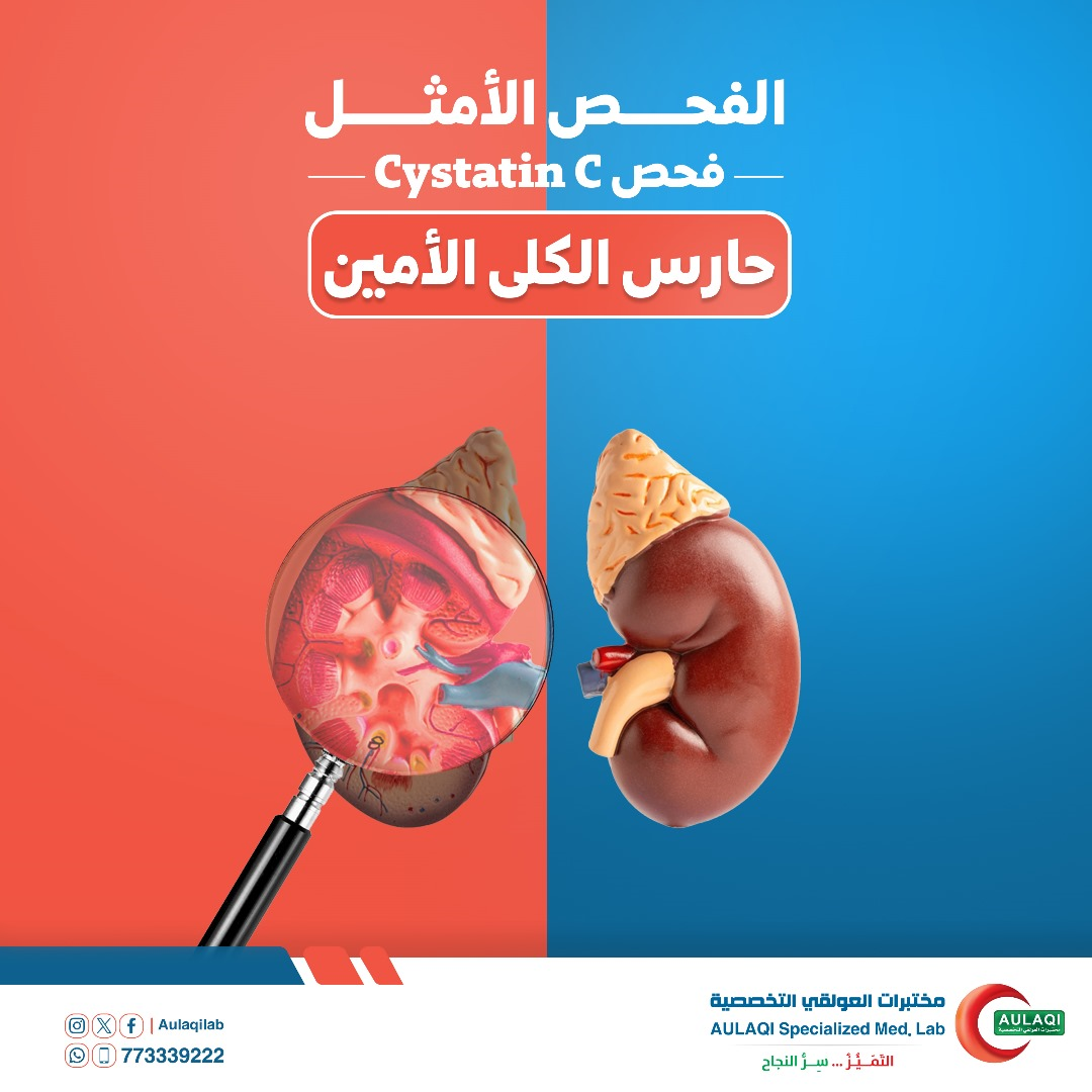 فحص تخصصي مهم جداً لمعرفة حالة الكلى  Cystatin C 