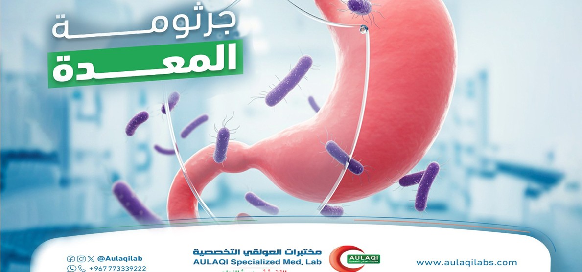 فحوصات جرثومة المعدة